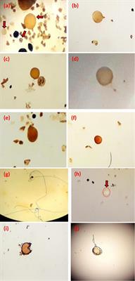 Effect of Arbuscular Mycorrhizal Fungi Isolated From Rock Phosphate Mine and Agricultural Soil on the Improvement of Wheat Plant Growth